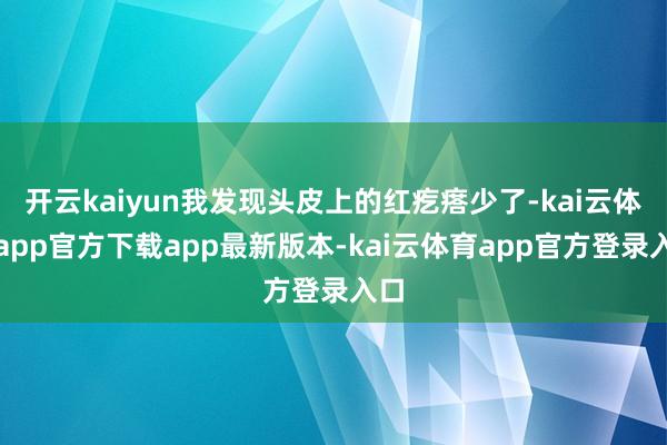 开云kaiyun我发现头皮上的红疙瘩少了-kai云体育app官方下载app最新版本-kai云体育app官方登录入口